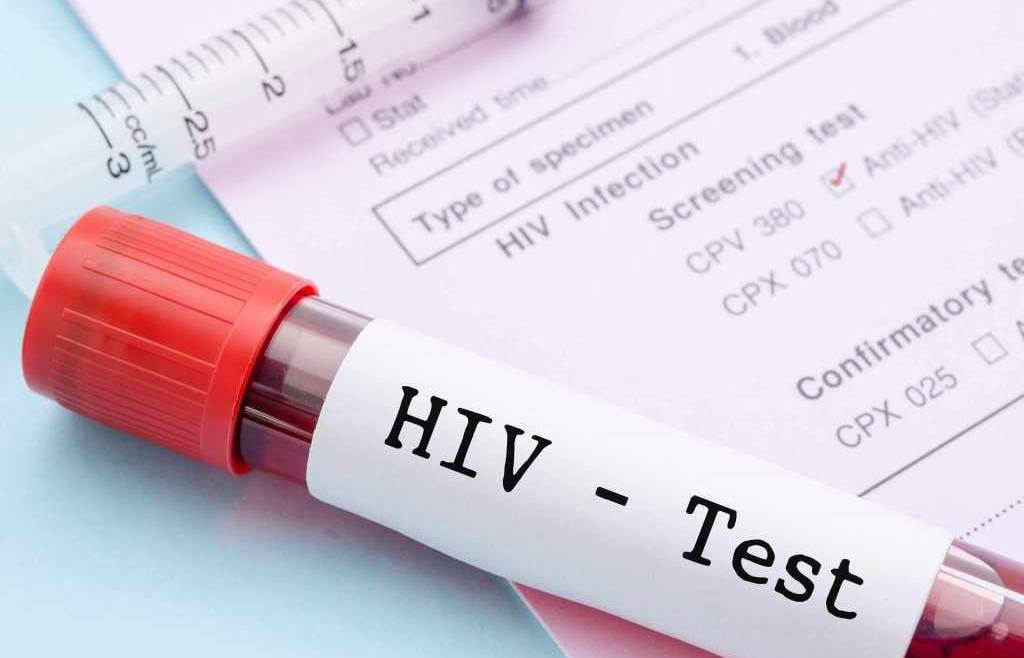 hiv test
